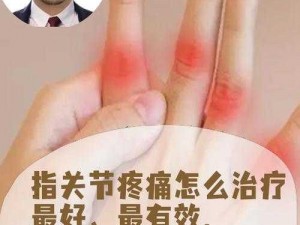 女生一根手指就痛可能是关节炎引起的