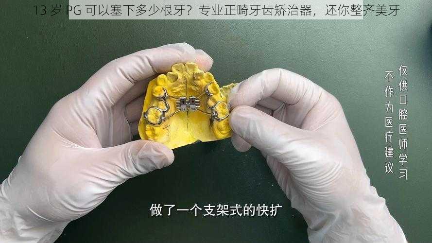 13 岁 PG 可以塞下多少根牙？专业正畸牙齿矫治器，还你整齐美牙